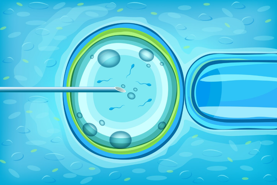 Frozen Embryo Transfer