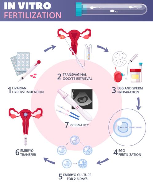 IVF Treatment