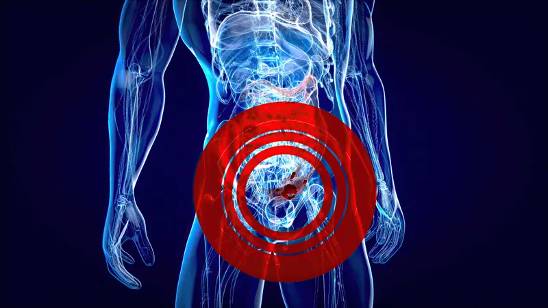 Prostate Cancer